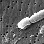 Electonmicroscopic picture of bacteria Klebsiella pneumoniae