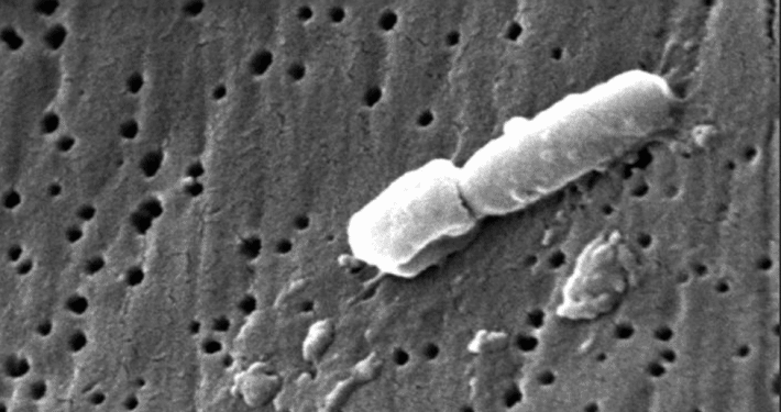 Electonmicroscopic picture of bacteria Klebsiella pneumoniae