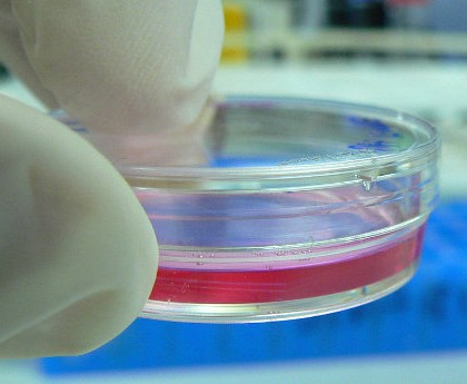 Cell Culture in a tiny Petri dish